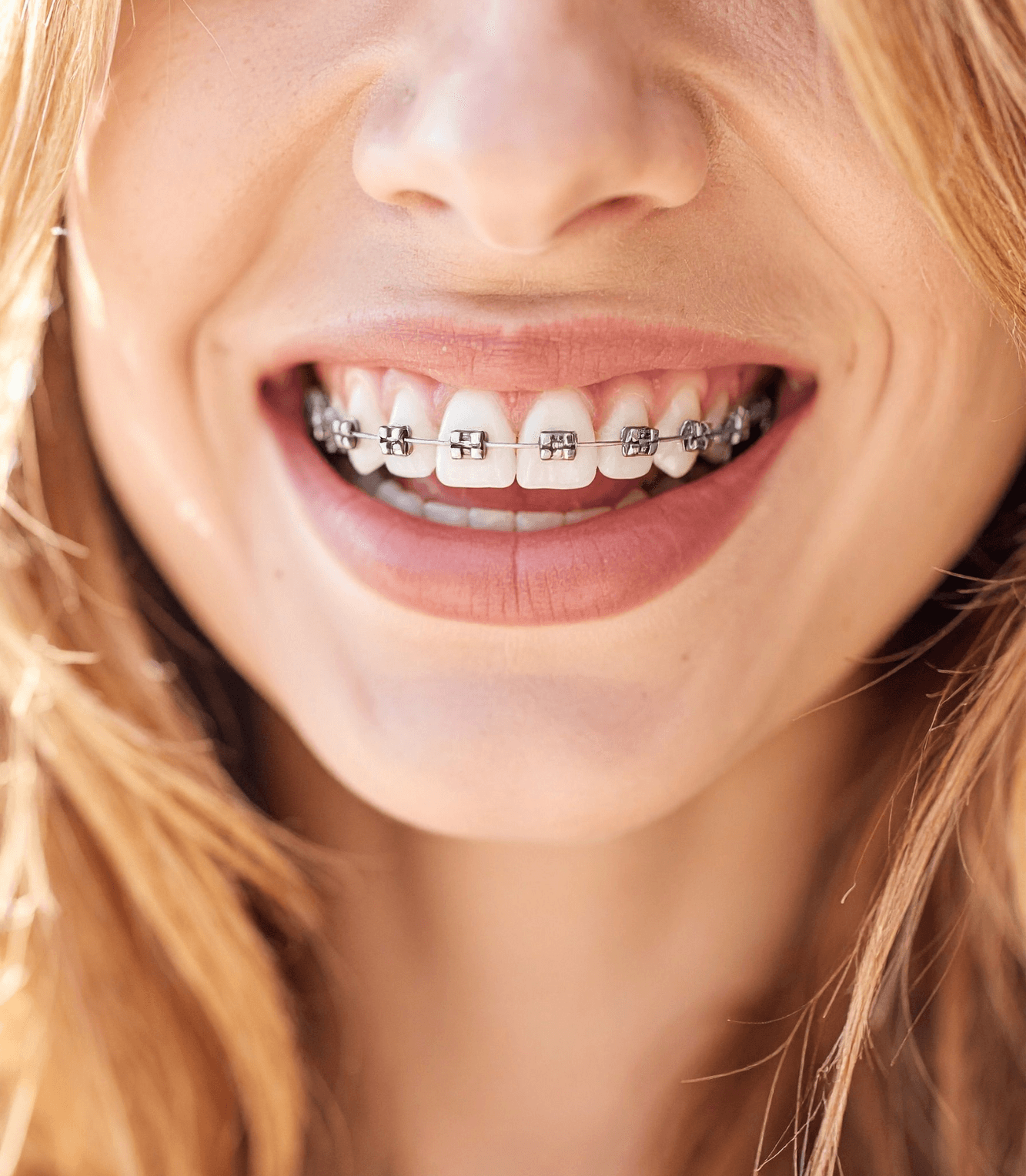 Financiar Brackets